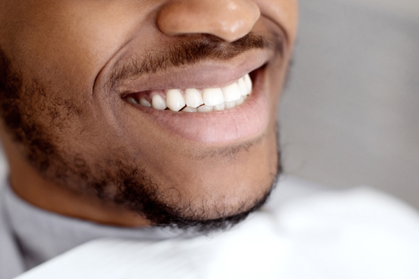 What You Need To Know About At Home Teeth Whitening From A Dentist